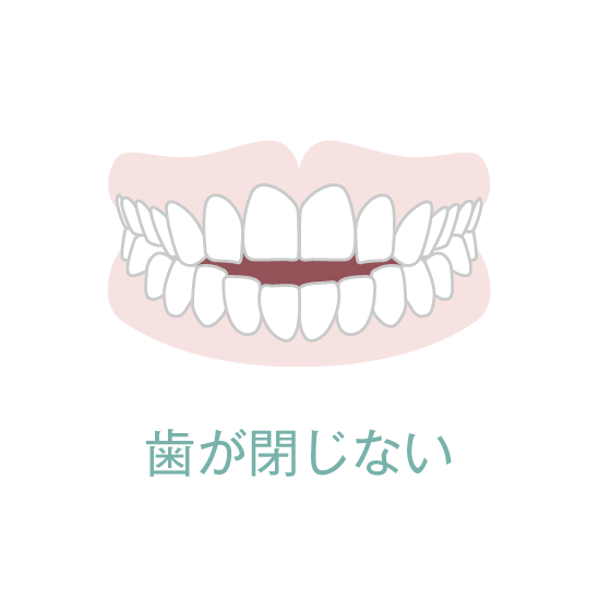 歯が閉じない
