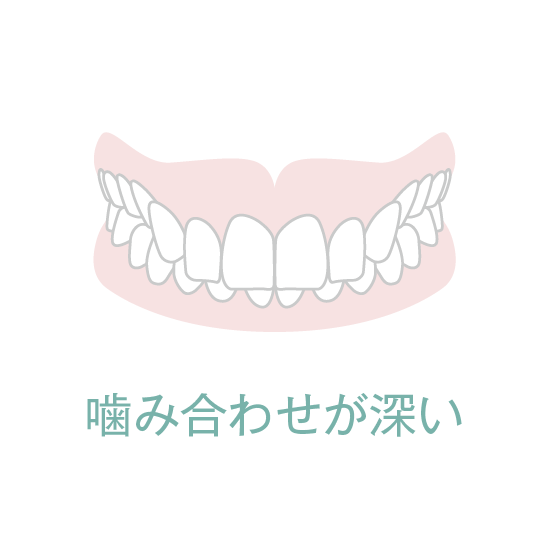 噛み合わせが深い