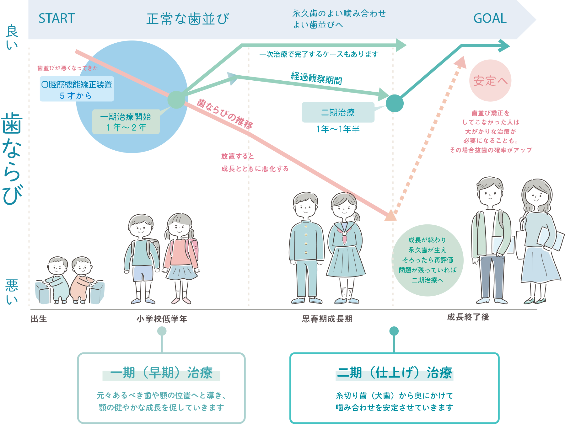 小児矯正のステップ