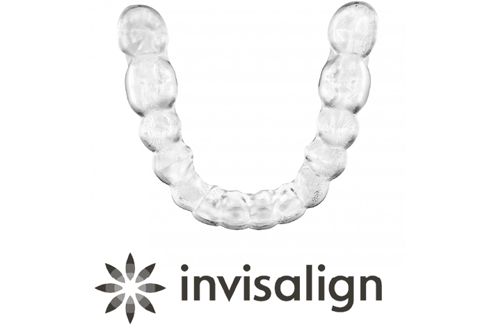 インビザライン